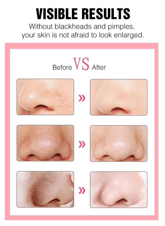 HYUNDAI 6-in-1 Facial Pore Cleaner Vacuum, Professional Blackhead Remover Tool with 65kPa Deep Suction, USB Rechargeable, 40 Min Runtime, for Acne, Oily & Sensitive Skin, Pain-Free Pore Extraction 7 8 - Image 4