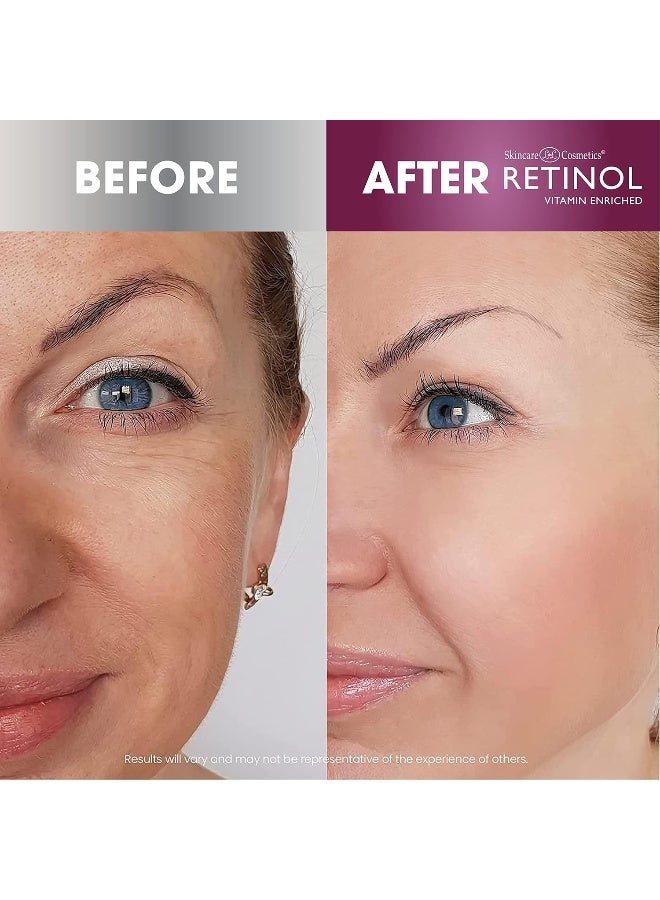 RETINOL Skincare LdeL Cosmetics Retinol Vitamin Enriched Anti-Wrinkle Facial Serum, 1 oz - Image 5