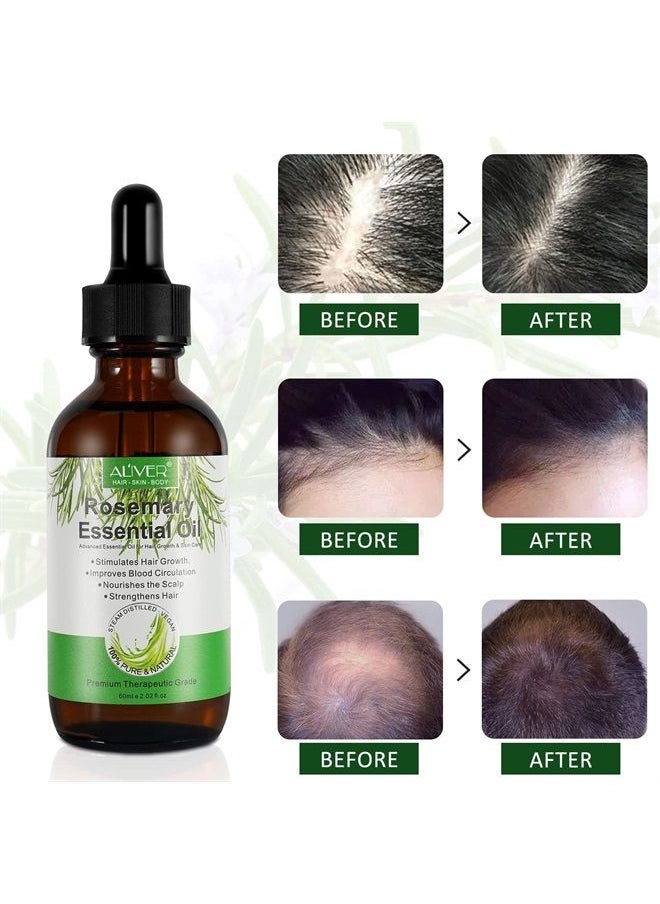 ALIVER - Rosemary Oil for Hair Growth, Hair Growth Serum for Hair, Enhanced Shine, 100% Pure Natural, Nourishment Scalp, Improves Blood Circulation, Best Rosemary Essential Oils for Hair Skin, 2 fl oz - Image 1