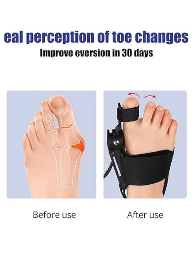 Toe Separator & Adjustable Bunion Corrector for Women - Comfortable Support - Day & Night Use - Fits Most Foot Sizes for Pain Relief - Image 2