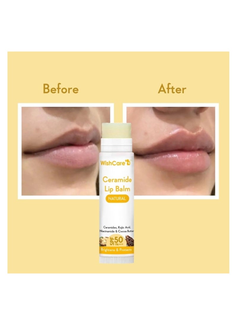 WishCare Ceramide Lip Balm with SPF50 PA+++ - Kojic Acid & Niacinamide - For Lip Lightening & Protection 5gm - pzsku/ZF9EC6401C6F03823FCA3Z/45/_/1739260517/36dad6d0-13a1-47c1-97ec-8cc1ad0d1c9f