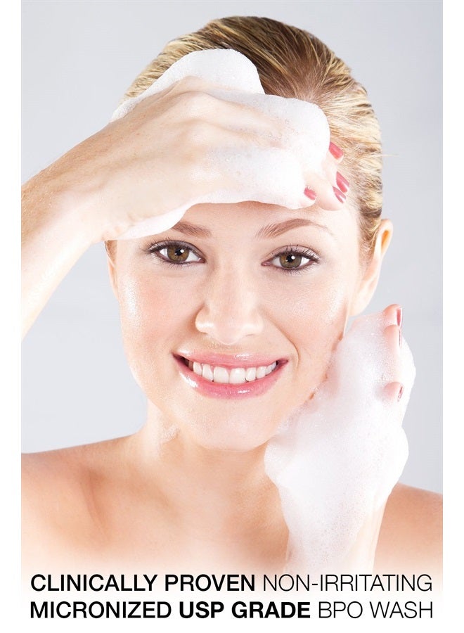 Benzoyl Peroxide 5% Acne Cleanser- Clinically Proven Wash to Fight Acne on Contact. Eliminates Cystic Breakouts, Oily Skin, Clogged Pores, Blackhead & Whitehead Pimples for Face & Body.