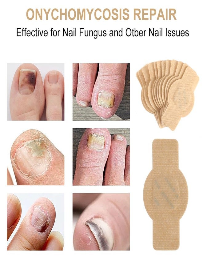 CXWUZH Nail Patches for Toenails 30 Pcs Toenail Treatment with Hydrogel Overnight Repair for Damaged Toenails - Image 4