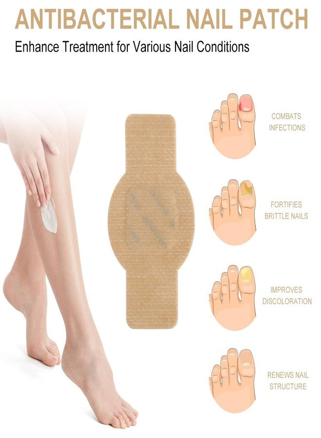 CXWUZH Nail Patches for Toenails 30 Pcs Toenail Treatment with Hydrogel Overnight Repair for Damaged Toenails - Image 3