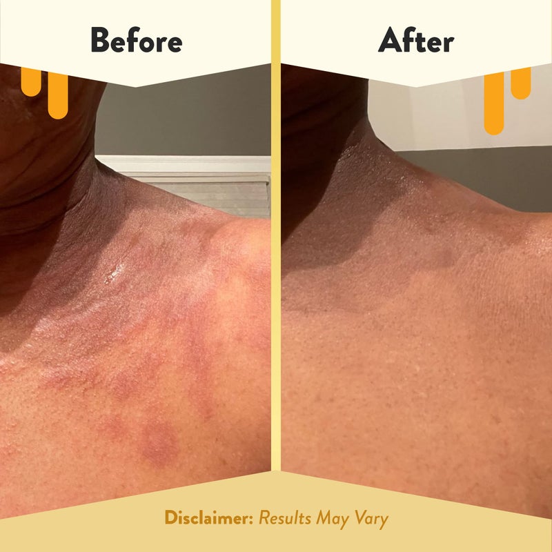 ECZEMA HONEY Gentle Oatmeal and Lavender Soap - Natural Eczema Body Wash - Daily Gentle Soap for Dry, Itchy, Sensitive,  Irritable Skin (3.3 Oz) - Image 4