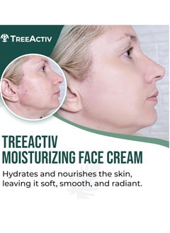 TreeActiv TreeActiv Acne Cream Original Formula, 2 fl oz, 2% Salicylic Acid Face Moisturizer for Oily Skin, Skin Care Acne Formula for Cystic Acne Treatment, Hydrating Face Moisturizer for Acne Prone Skin  - Image 2