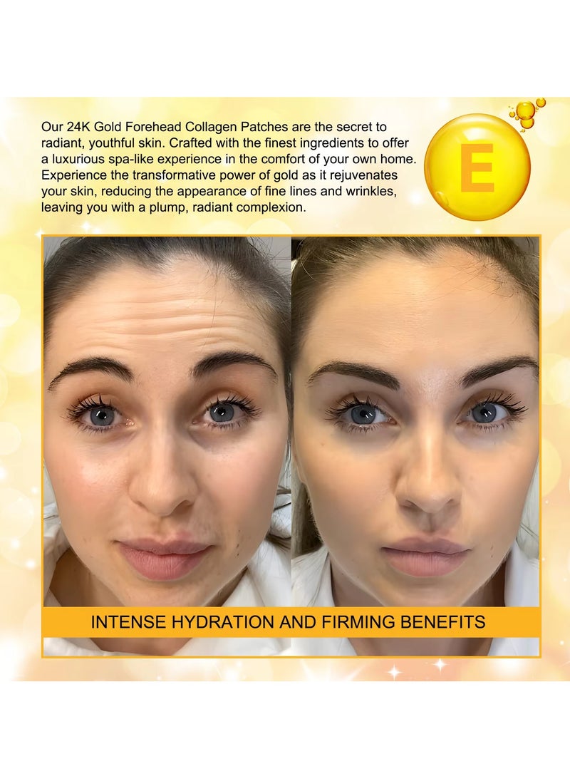 Yecuce 12Pcs 24K Gold Forehead Collagen Patches Forehead Wrinkle Patches with Aloe Vera Collagen Shea Butter and Vitamin E Smooth Fine Line and Wrinkles Anti Wrinkle Forehead Wrinkle Treatment Patch  - Image 5