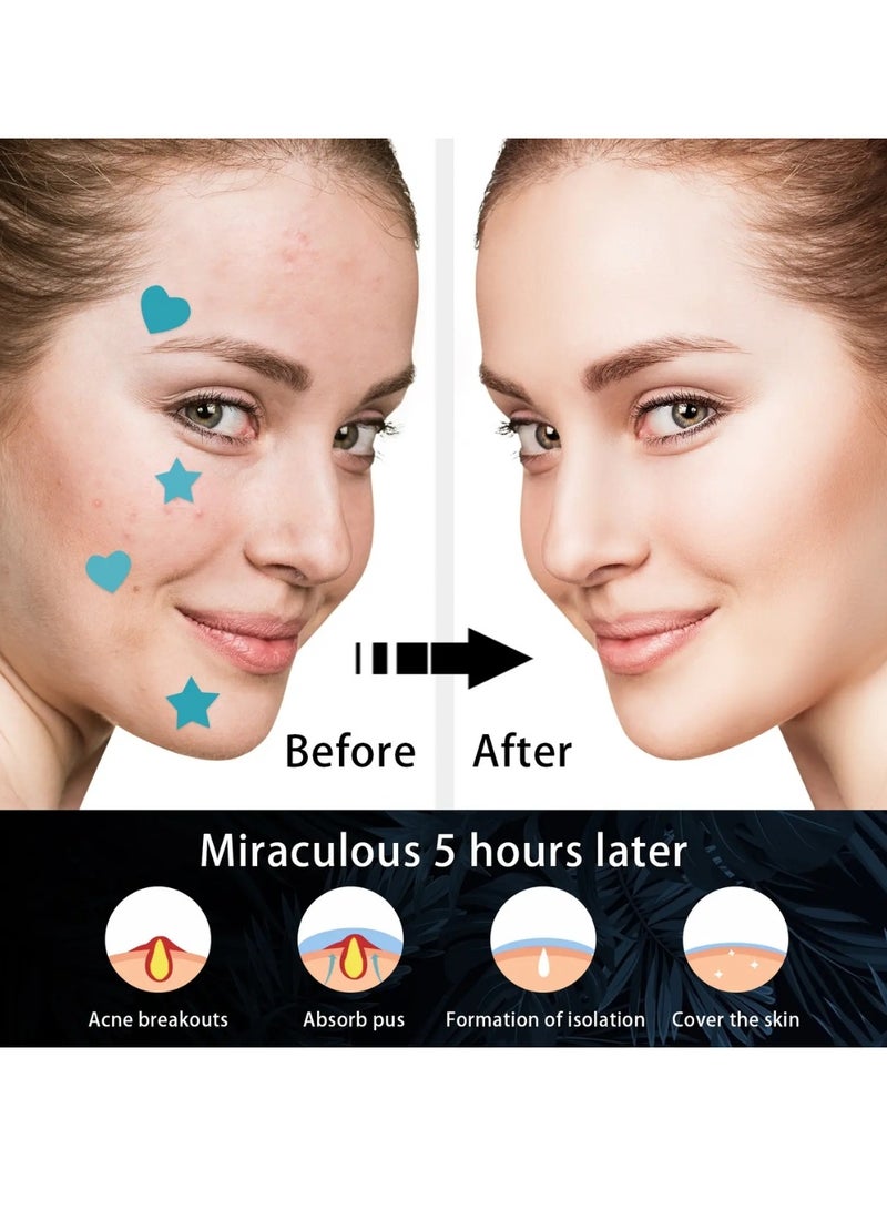 WEST MONTH 216 Pcs Pimple Patch Acne Pimple Patches Star and Heart Shape Acne Patch Treatment Face Pimple Patches Spot Cover Stickers Acne Healing Miracle Patches Acne Care Pimple Patch Absorbing Cover Acne Spot Treatment Stickers - Image 3