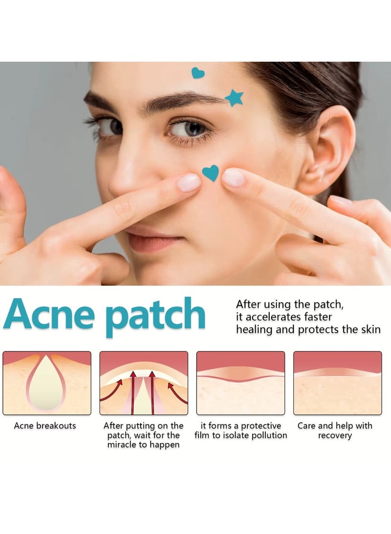 WEST MONTH 216 Pcs Pimple Patch Acne Pimple Patches Star and Heart Shape Acne Patch Treatment Face Pimple Patches Spot Cover Stickers Acne Healing Miracle Patches Acne Care Pimple Patch Absorbing Cover Acne Spot Treatment Stickers - Image 5