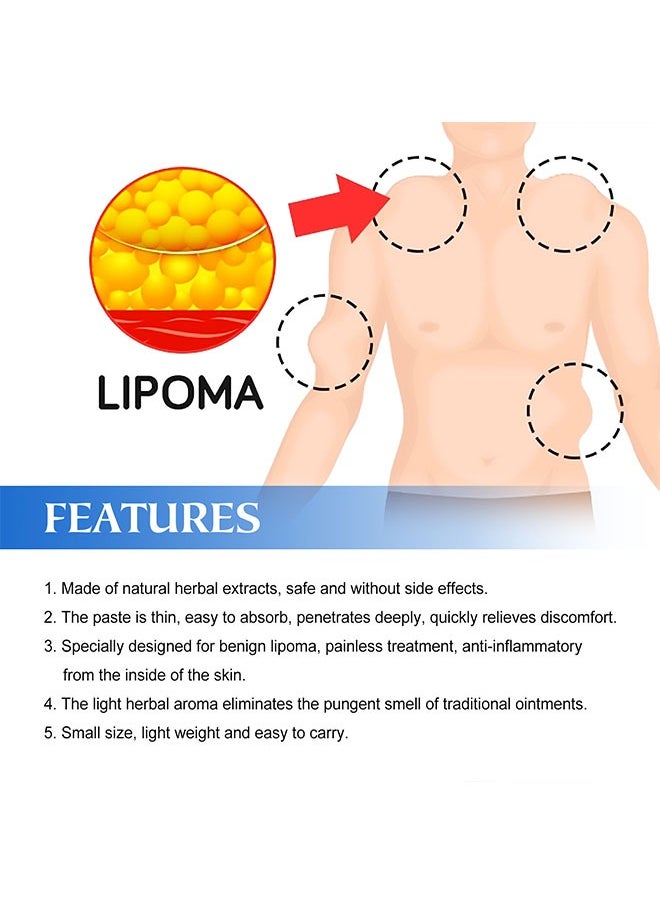 SOUTH MOON - Lipoma Cream 20g, Natural Ingredients, Easy to Absorb, Reduce The Size of Fat Tumors, Relieve Pain and Neurological Discomfort, Lipoma Elimination Cream - Image 1