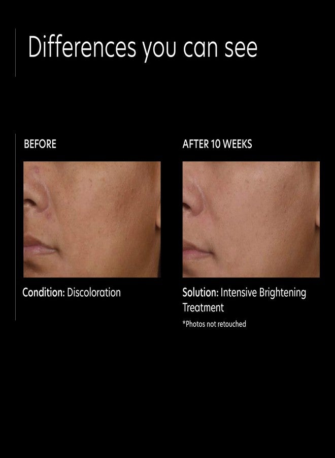 PCA SKIN علاج تفتيح مكثف من PCA SKIN - سيروم وجه بتركيز 0.5% من فيتامين A النقي (ريتينول) لتصبغات البشرة والبقع الداكنة (30 مل) - Image 4