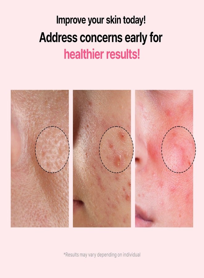 VEGANIFECT Pore Refining Ampoule, Pore Tightening, Reduce Sebum, Korean Skin Care, Vegan, 1.69 Fl Oz - Image 3