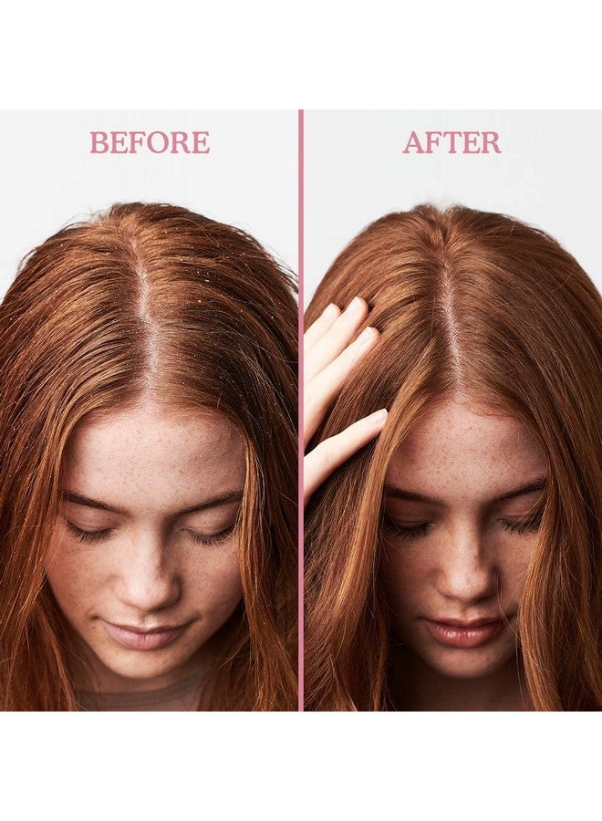 Umberto Giannini Scalp Restore Shampoo Vegan & Cruelty Free Scalp Reviving Antidandruff Formula With Super Fruit Enzymes 250 Ml - Image 3