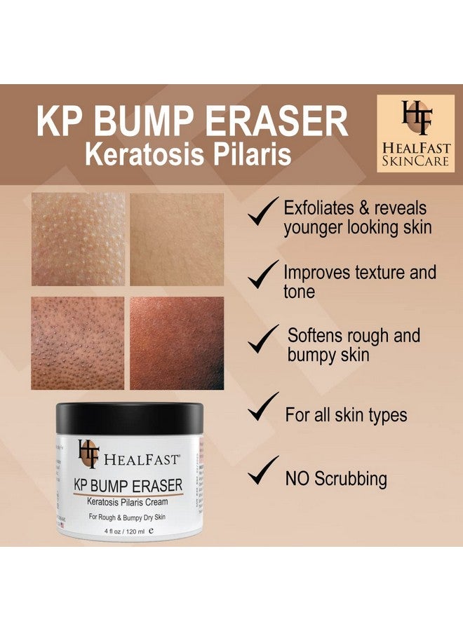 هيل فاست مجموعة كريم Healfast KP لإزالة البثور (4 أونصة) وغسول الجسم (8 أونصة) - لتنعيم وتقشير وتغذية البشرة الخشنة والمتشققة - لعلاج التقرن الشعري - لجميع أنواع البشرة - Image 4