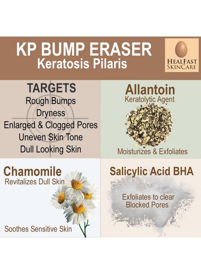 هيل فاست مجموعة كريم Healfast KP لإزالة البثور (4 أونصة) وغسول الجسم (8 أونصة) - لتنعيم وتقشير وتغذية البشرة الخشنة والمتشققة - لعلاج التقرن الشعري - لجميع أنواع البشرة - Image 5