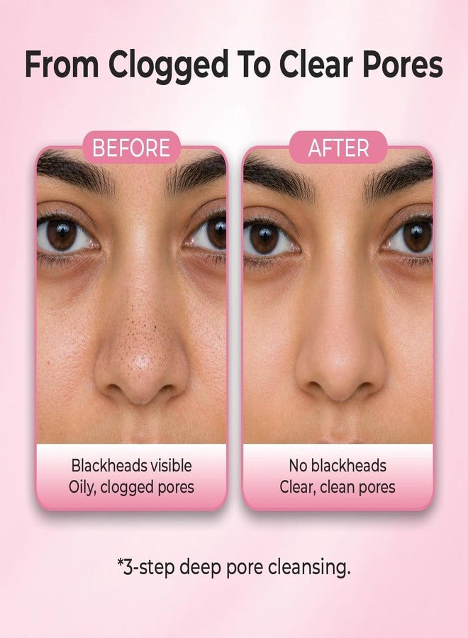 Sanfe Aloe Vera 3 Step Nose Kit | 3 Units | Nose Strips for Blackhead Removal Routine | Deep Cleansing Pore Cleaning Strips for Oily Skin Care | At Home Cleansing Kit | Peel-Off Mask Style (Pack of 3) - Image 2