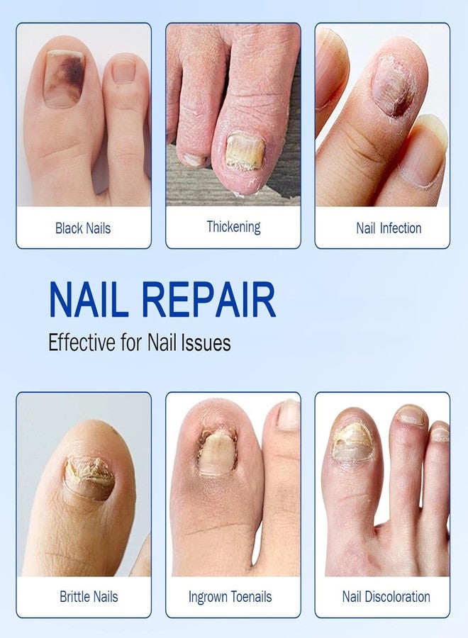 IQS Enterprise Nail Patches for Toenails Bag Toenail Extra Strength, Nighttime Nail Repair for Damaged, Discolored Nails, Safe for Sensitive Skin, Easy to Apply (1 pack) - Image 4