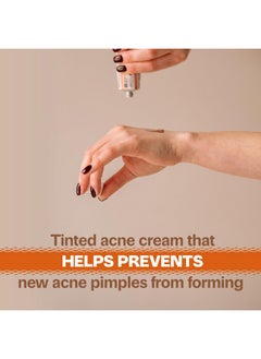 CERTAIN DRI Adult Acnomel Acne Medication Cream 1.3 Ounces  - Image 2