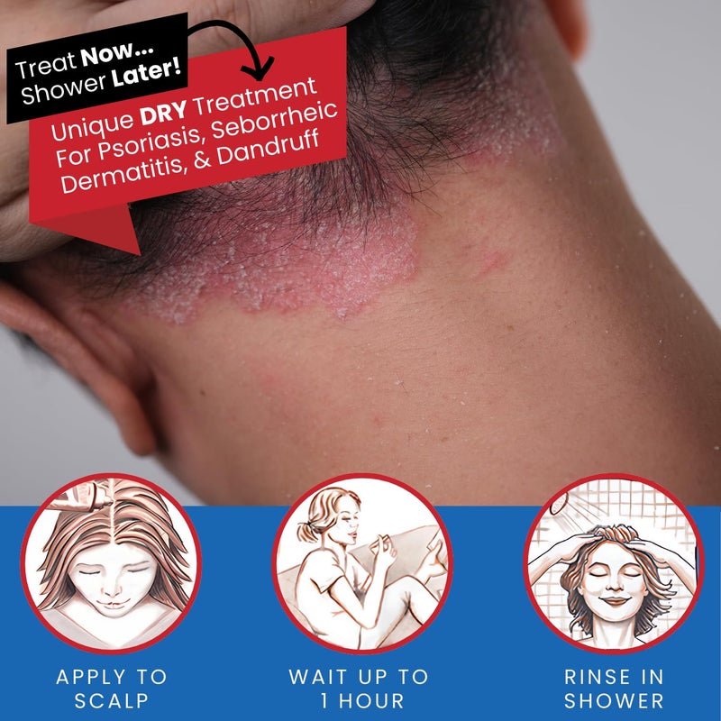 Tarsum Extra Strength Psoriasis Shampoo - Coal Tar Shampoo and Conditioner for Scalp Psoriasis, Seborrheic Dermatitis, Severe Dandruff, & Eczema - Exfoliating Relief for Flaky, & Itchy Scalp (8 oz) - Image 3