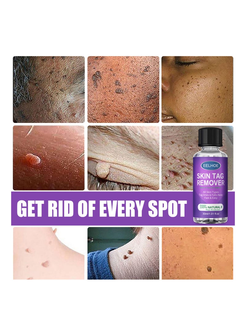 EELHOE Natural Organic Skin Tag Remover 30 Ml - Image 5