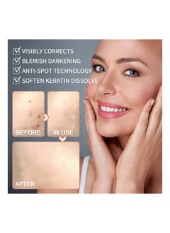 EELHOE Natural Organic Skin Tag Remover 30 Ml  - Image 2