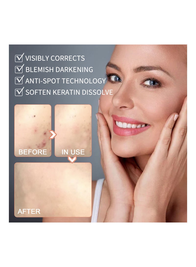 EELHOE Natural Organic Skin Tag Remover 30 Ml - Image 2