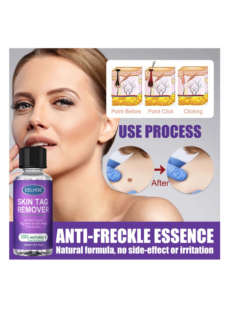EELHOE Natural Organic Skin Tag Remover 30 Ml - Image 1
