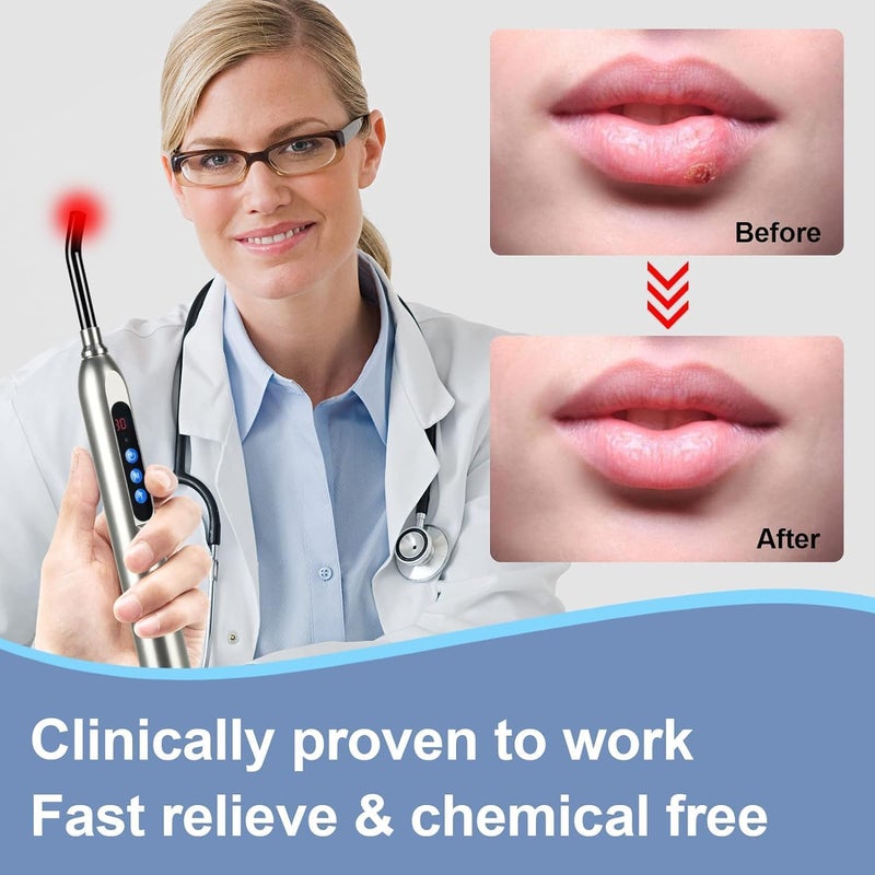 MCJ Cold Sore Light Therapy Device Canker Sore Treatment Fever Blister  Mouth Ulcer Relief with Silver Tip FaceNose - Image 2