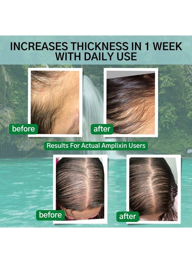 Amplixin - Dht Blocker Hair Growth Shampoo And Hair Loss Revitalizing Conditioner Set For Thinning Hair For Men & Women ; Clinically Proven 2 Step Treatment ; Color Safe ; Paraben & Sulfate Free ; By - Image 1