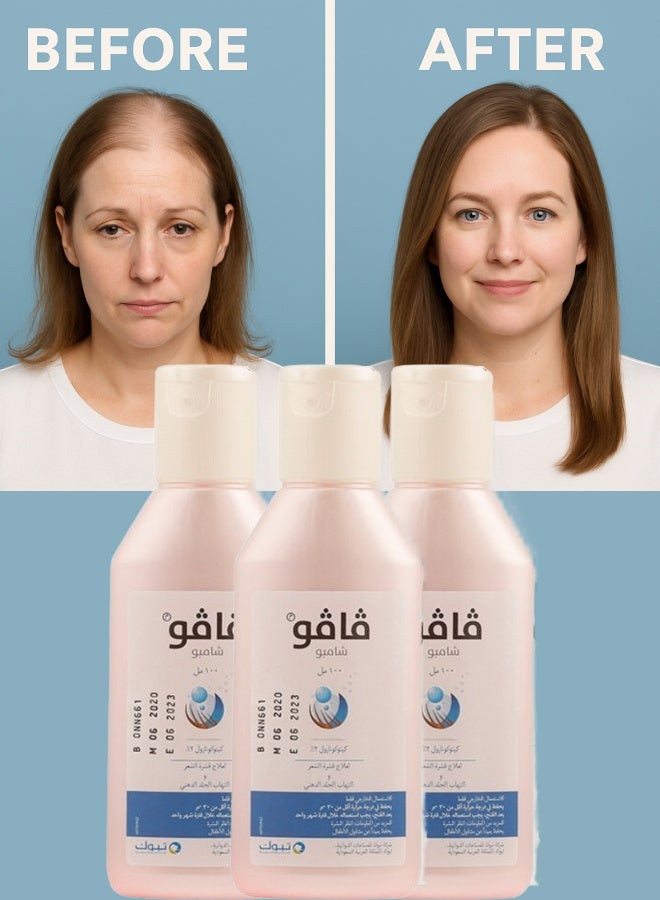 فافو 3 قطع فافو 2% شامبو 100مل - Image 1