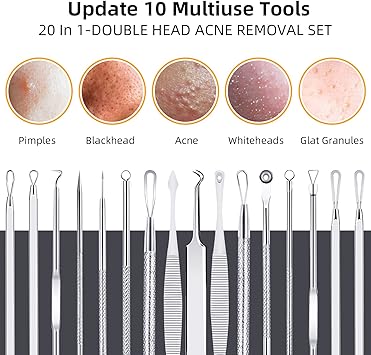 AIBEE 10 Pcs Blackhead Remover Pimple Popper Tool KitComedone Extractor Tools for Acne BlackheadWhiteheadPimplesSpotZit Removal Tool on Nose Face Skin - Image 2