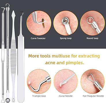 AIBEE 10 Pcs Blackhead Remover Pimple Popper Tool KitComedone Extractor Tools for Acne BlackheadWhiteheadPimplesSpotZit Removal Tool on Nose Face Skin - Image 5