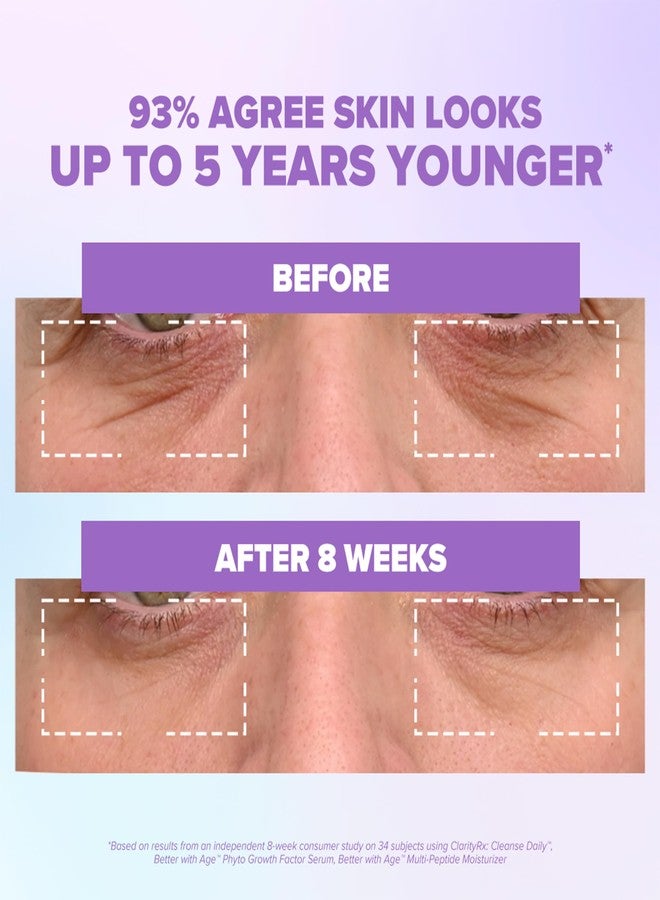 كلاريتي آر إكس سيروم الوجه ClarityRx Better With Age Phyto Growth Factor، 0.9 أونصة سائلة، سيروم مرطب مضاد للشيخوخة مع خلايا جذعية نباتية، يساعد على دعم إنتاج الكولاجين وحمض الهيالورونيك، وينعم الخطوط الدقيقة بشكل ملحوظ. - Image 5