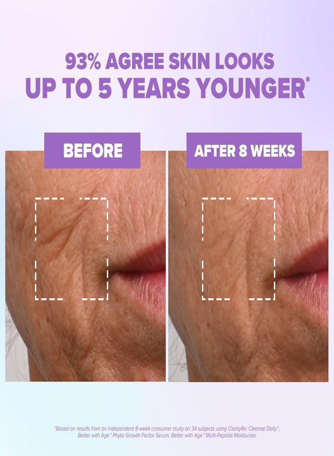 كلاريتي آر إكس سيروم الوجه ClarityRx Better With Age Phyto Growth Factor، 0.9 أونصة سائلة، سيروم مرطب مضاد للشيخوخة مع خلايا جذعية نباتية، يساعد على دعم إنتاج الكولاجين وحمض الهيالورونيك، وينعم الخطوط الدقيقة بشكل ملحوظ. - Image 4