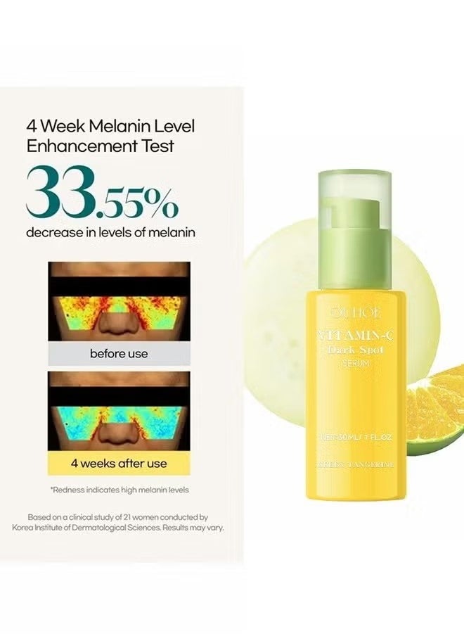 OUHOE - Green Tangerine Vitamin C Serum,Niacinamide acid Help Fade Sun Spots and Dark Spot,For Face & Neck and Eye Care Organic Anti-Aging Serum (30ml) - Image 1