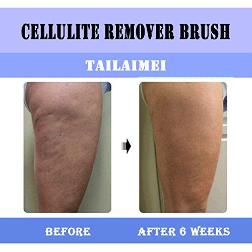 TailaiMei Anti Cellulite Massager Brush, Body Shower Scrubber for Cellulite Remover - Improve Circulation Fascia Muscle Release Brush(Blue) - Image 3