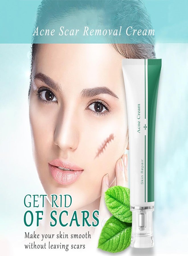 MIESCHER Scar Cream, Face Pimples Scar Stretch Marks Cream Moisturizing Repair Damaged Skin Gel Scar Treatment - Image 4