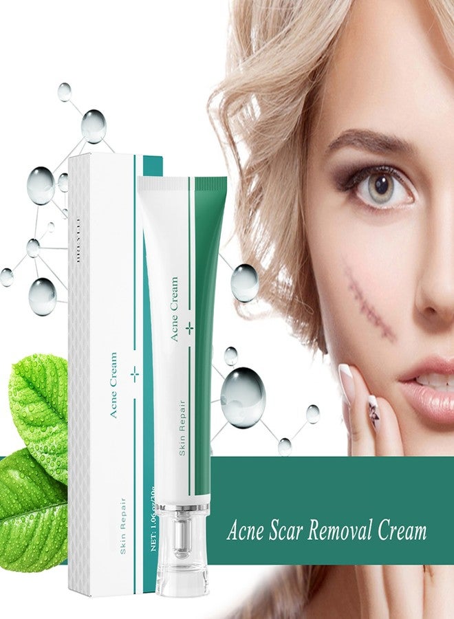 MIESCHER Scar Cream, Face Pimples Scar Stretch Marks Cream Moisturizing Repair Damaged Skin Gel Scar Treatment - Image 2