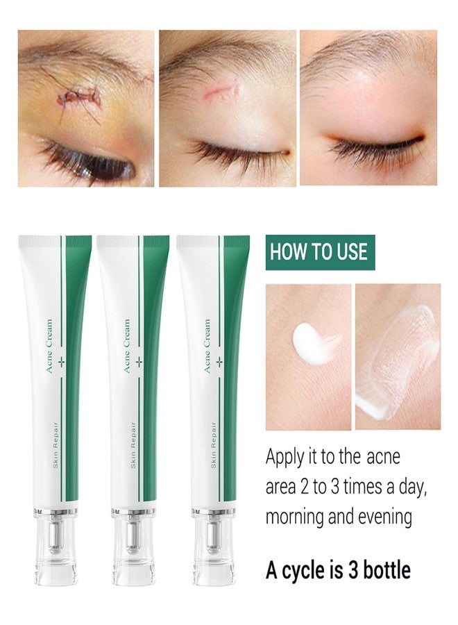 MIESCHER Scar Cream, Face Pimples Scar Stretch Marks Cream Moisturizing Repair Damaged Skin Gel Scar Treatment - Image 3