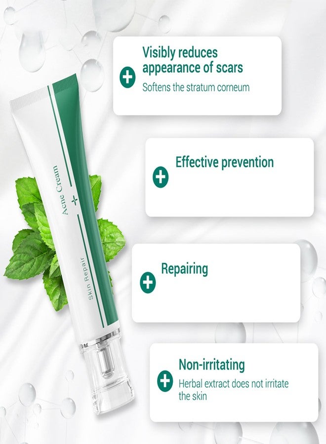 MIESCHER Scar Cream, Face Pimples Scar Stretch Marks Cream Moisturizing Repair Damaged Skin Gel Scar Treatment - Image 5