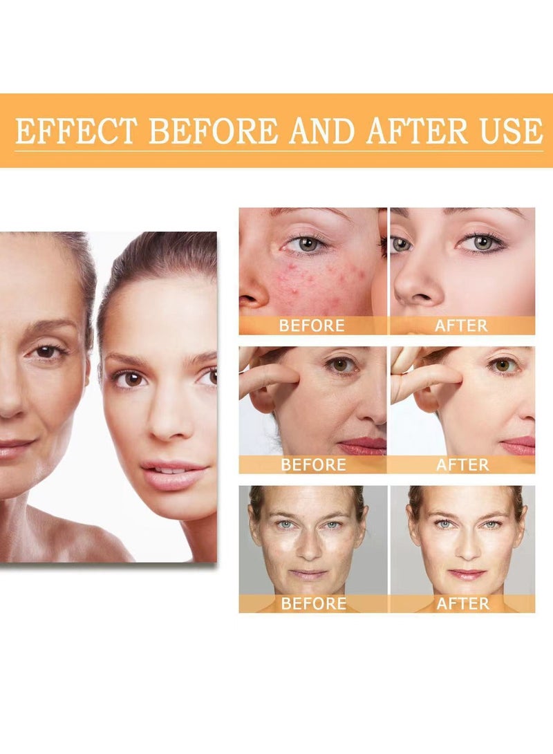 LUNOON Glycolic Fruit Acid Skin Lotion To Remove Closed Acne And Moisturize Skin 7% Glycolic Acid Glycolic Acid Rejuvenating Lotion 240ml - Image 2