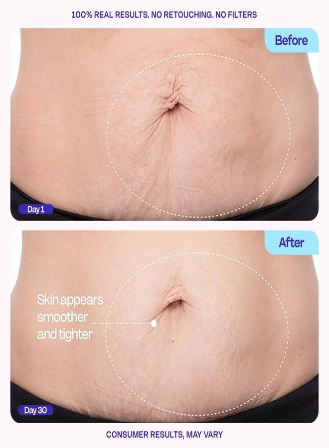 جو بيور كريم شد البطن من جو بيور - مرطب لشد الجسم لتقليل السيلوليت وعلامات التمدد، 4.25 أونصة - Image 3