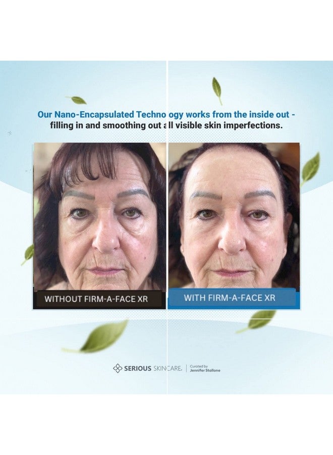 Serious Skincare Firm A Face XR - Instant Skin Tightener - Reduce and Smooth Appearance of Fine Lines, Wrinkles and Enlarged Pores - Temporary and Invisible Lift for Face and Neck - 3.2 Fl Oz - Image 4