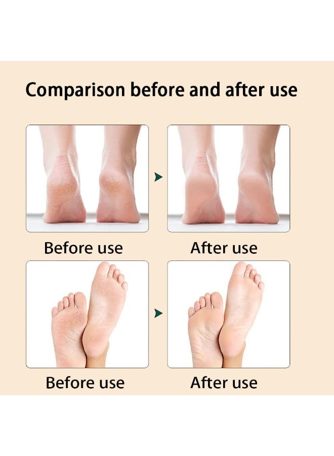 Foot callus remover - Stainless steel pedicure tool for removing rough calluses and smooth heels, soft feet, multi-colored home spa file - Image 3