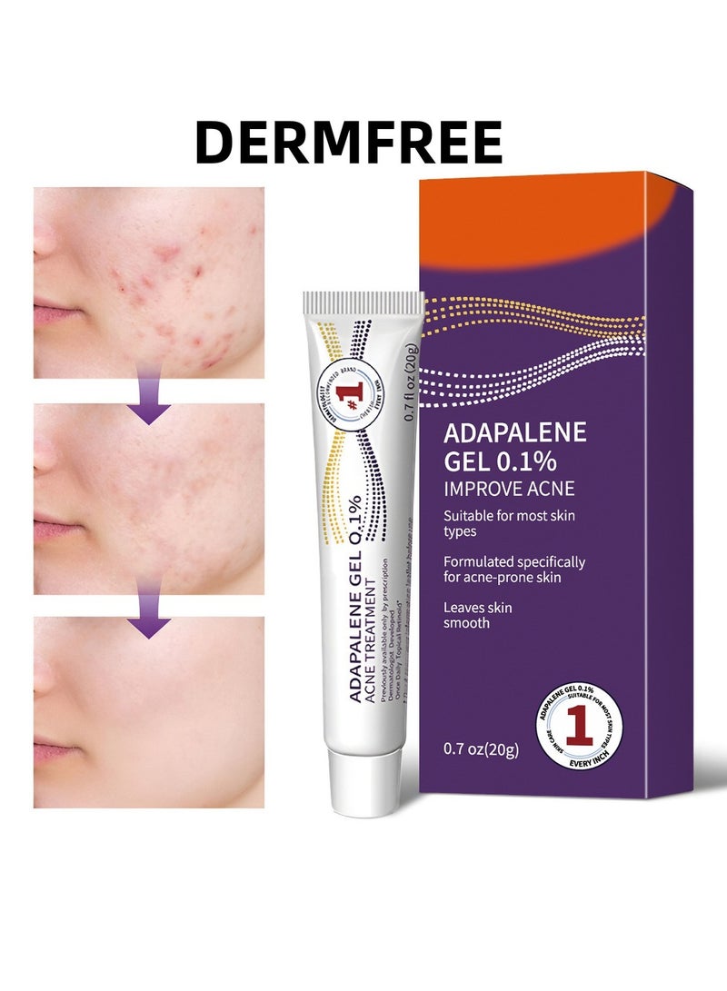DERMFREE Adapalene Gel Acne Treatment Acne Treatment Cream Acne Treatment Ointment Gel Acne Relief Cream Gentle Moisturizing Acne Removing Gel Pimple and Acne Removal Anti Acne Gel 20g - Image 1