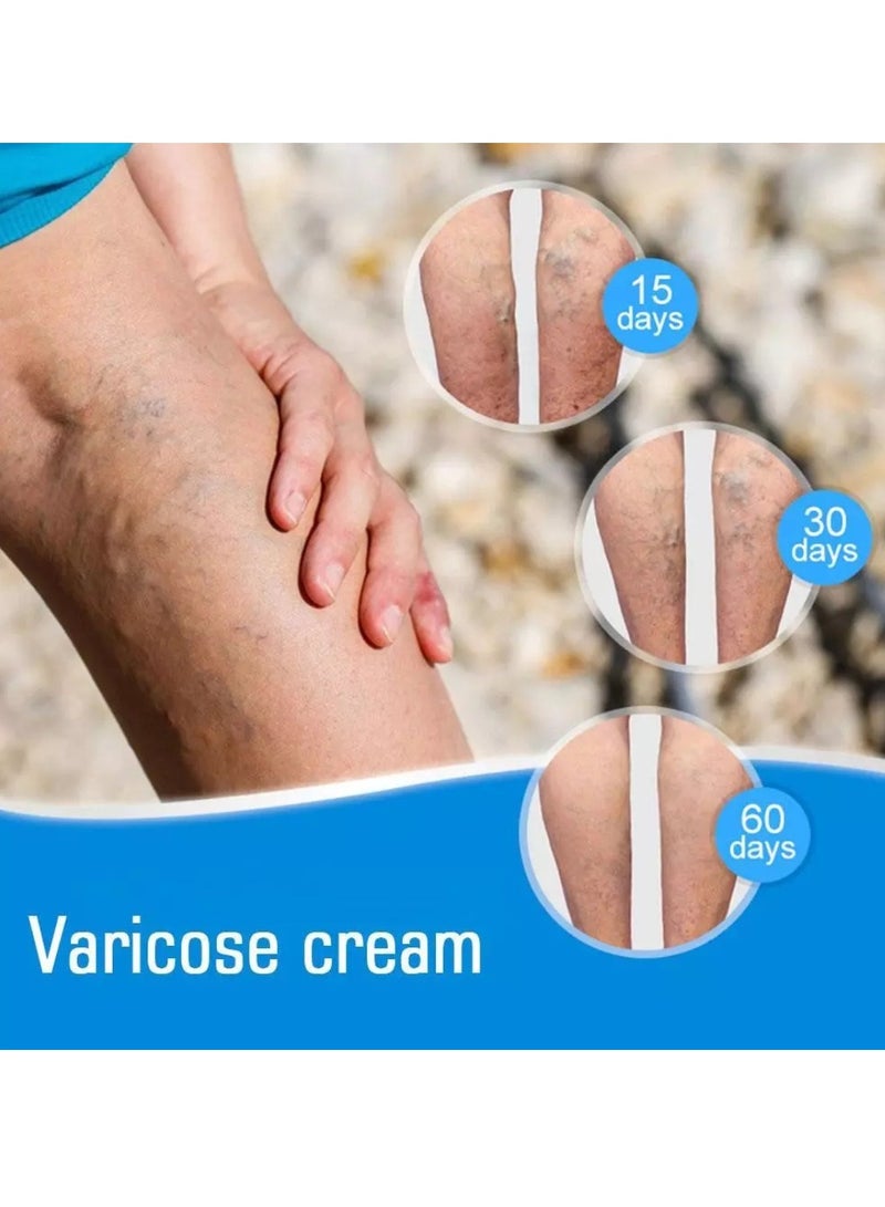 Sumifun كريم دوالي الساقين لعلاج دوالي الساقين مرهم عشبي للقضاء على دوالي الساقين والأوردة العنكبوتية كريم مزيل دوالي الساقين 20 جرام - Image 4