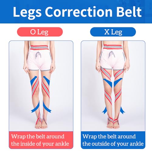 GHORTHOUD O/X Legs Correction Belt Legs Posture Corrector Band Unisex O/X Legs Type Legs Bandage Lightweight Pediatric Straighten Belt for Men Women and Children for Day and Night (Small) - Image 3