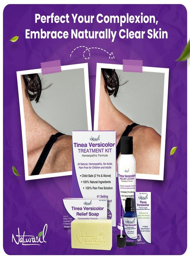 Naturasil Antifungal Tinea Versicolor Treatment Kit Gentle & Fast Relief for All Types of Tinea, Folliculitis, Itch & Chilblains| Safe for Kids & Adults| Sulfur Lotion (4oz) + 1 Relief Soap (4oz) - Image 2