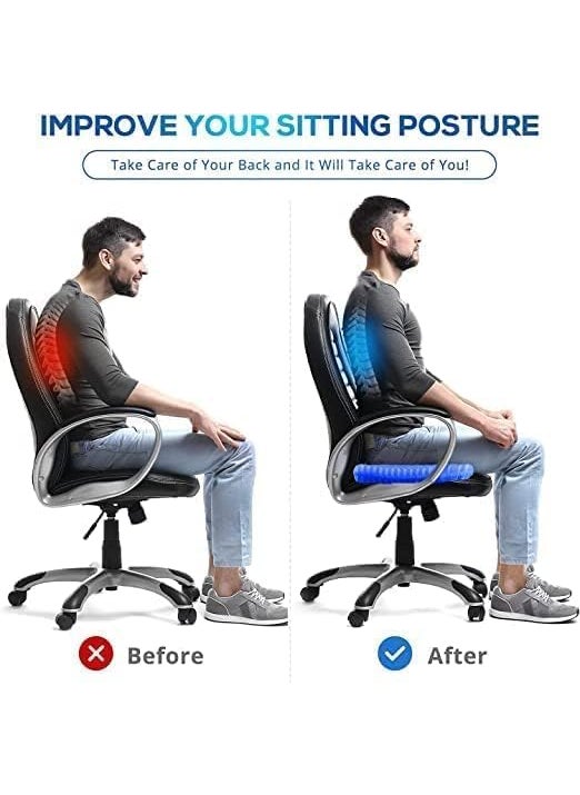 MIGORA MIGORA Egg Gel Seat Cushion Ergonomic Breathable Design Pressure Relief Sitter Tailbone Pain Sciatica Pain Back Pain Silicon Seater Cushion Chair Pad with NonSlip Cover for Home Office CarPack of 1  - Image 2