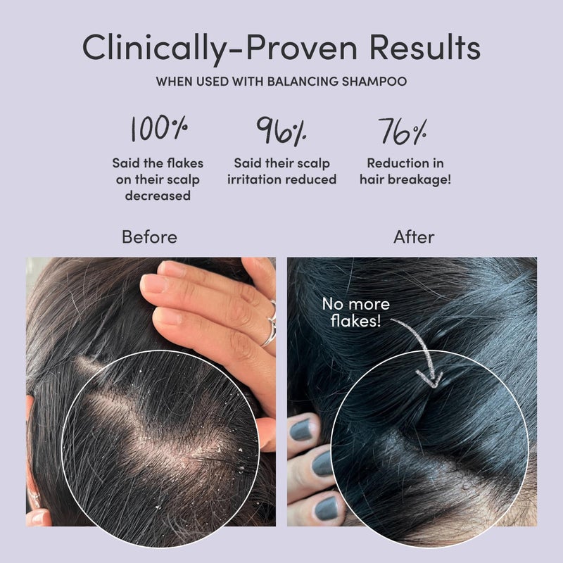 Jupiter, Physician-Formulated Scalp Balancing Conditioner for Dry, Itchy, Oily, Flaky Scalp, Sulfate-Free, Natural Fragrance, Vegan, Color-Safe, & Paraben-Free Conditioner for Women & Men - Image 2